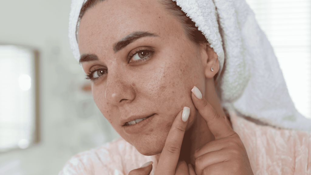 HPI | Dra. Camila Laranjo | Dermatologista