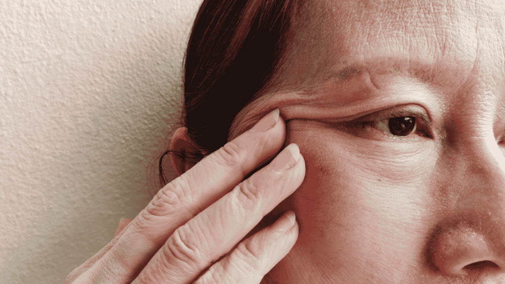 Flacidez Facial e Corporal | Dra. Camila Laranjo | Dermatologista