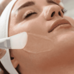 Peeling Químico | Dra. Camila Laranjo | Dermatologista