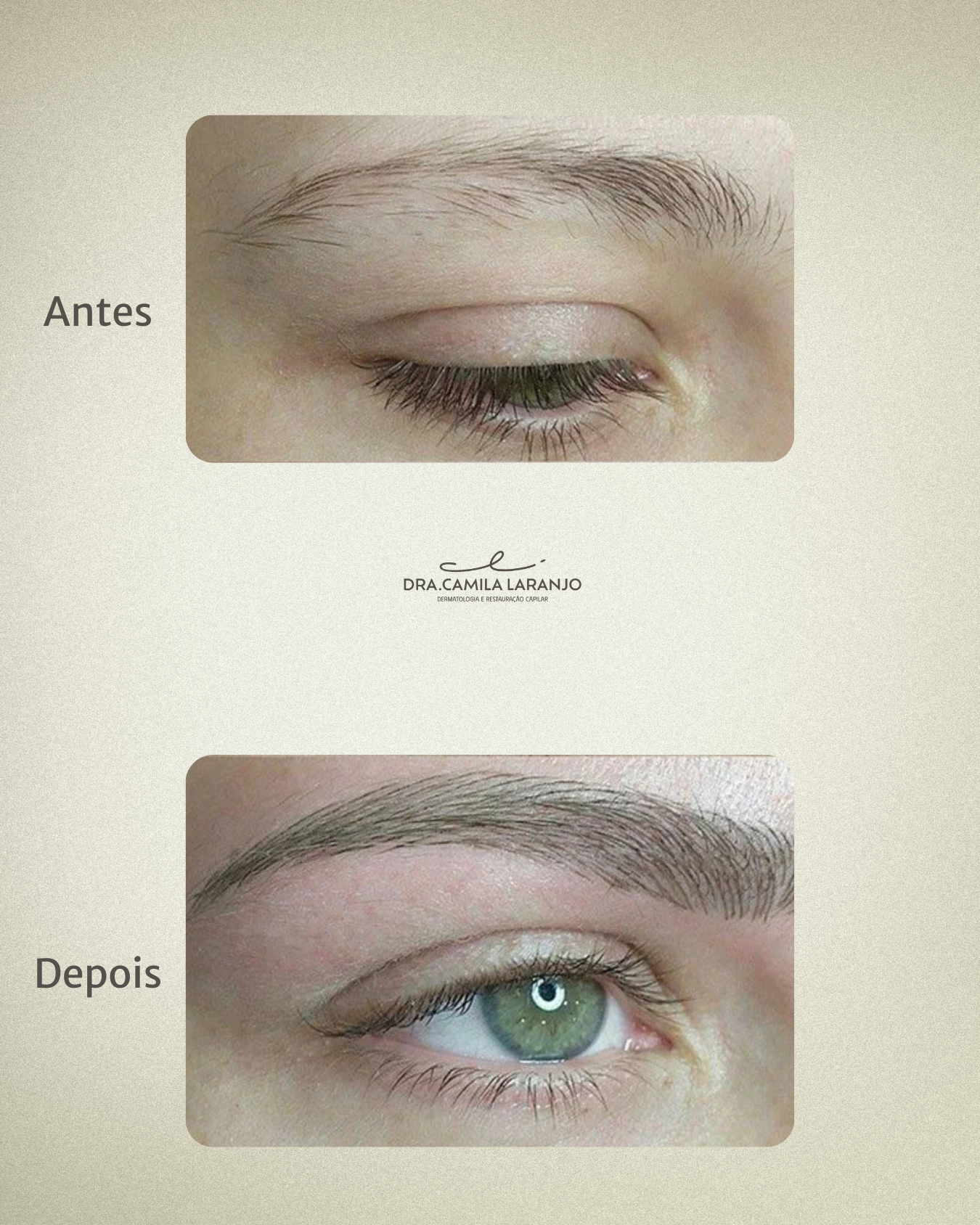 Antes e Depois - Caso 3