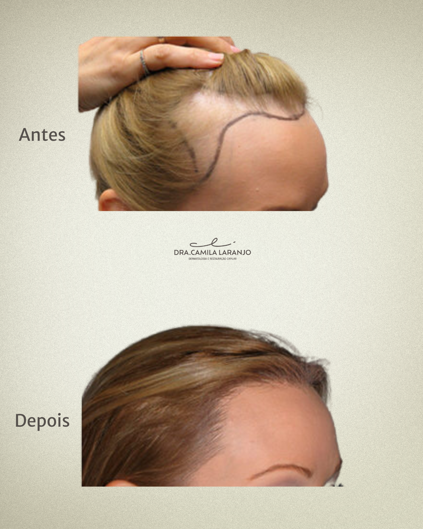 Antes e Depois - Caso 4